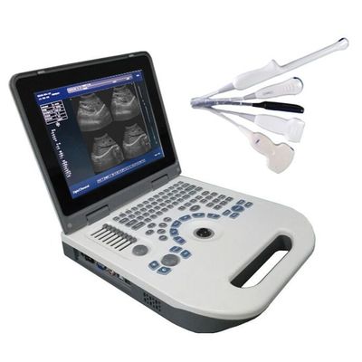Kwaliteit  TGC Control Notebook Ultrasound Scanner For Pregnancy Home Use Fabriek