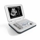 15 inch LED Color Portable Ultrasound Machine met 60° Scan Angle en 8 TGC Control