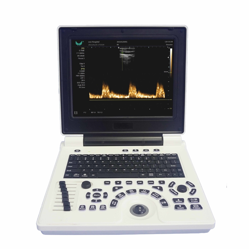 Van de Kleurendoppler van OB GYN Draagbare de Ultrasone klankmachine in Zwangerschap