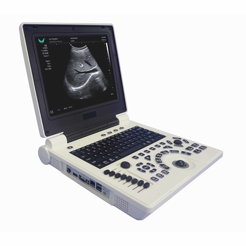 Van de Kleurendoppler van OB GYN Draagbare de Ultrasone klankmachine in Zwangerschap