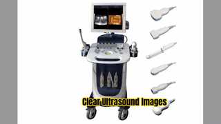 Doppler-echografiescanner PW CFM PDI-modus