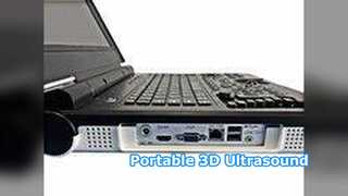 Draagbare echografie E20 klinisch ziekenhuis