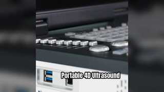 Draagbare 4D Doppler-echografiemachine, gereed voor ICU