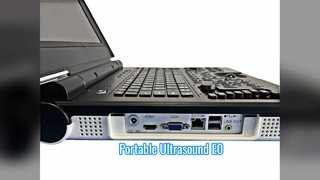 Draagbare kleurendoppler-echografie E0 Urologiescan